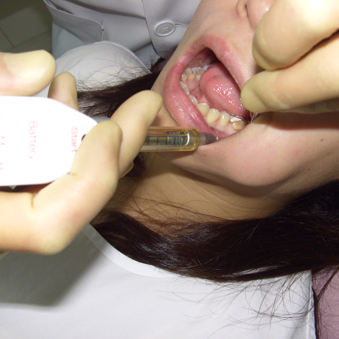 痛みの少ない治療